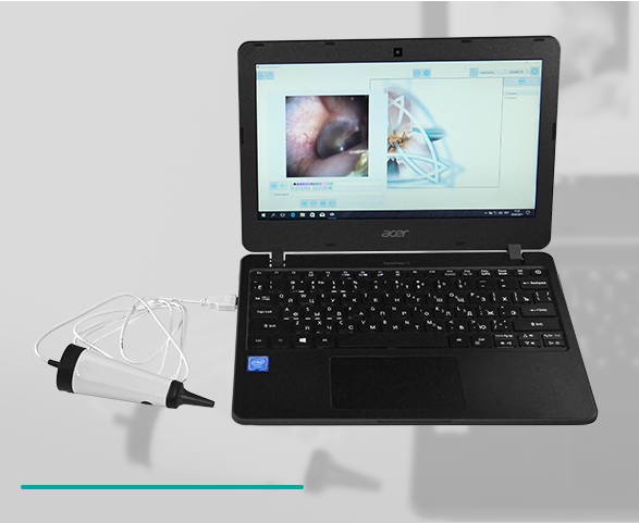 Видеоотоскоп подключение
